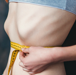 Anorexia Nervosa- What isit?
