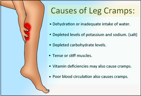  Causes of Leg Cramps in pregnancy