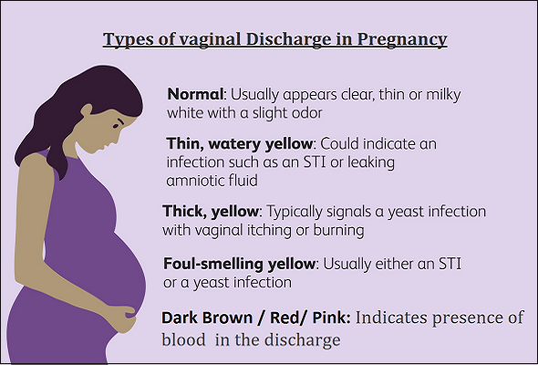  Types of Vaginal Discharge in pregnancy